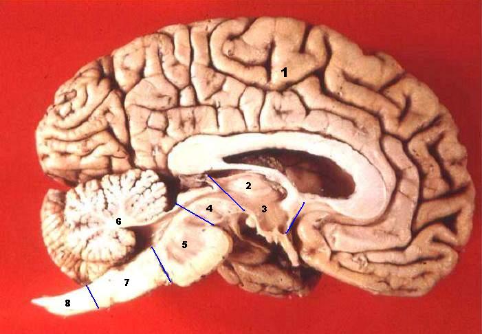 The four main brain regions, seen in a cut down the middle