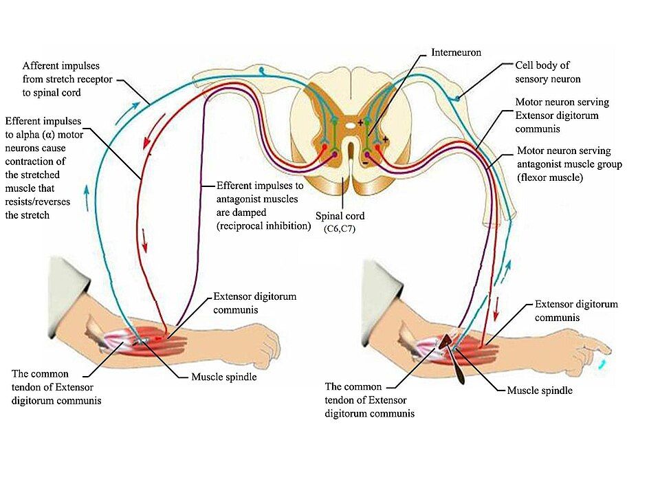 A stretch reflex, with the opposite muscle relaxing