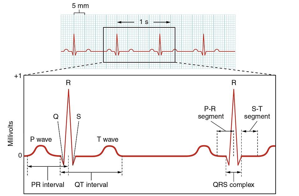 A normal ECG tracing