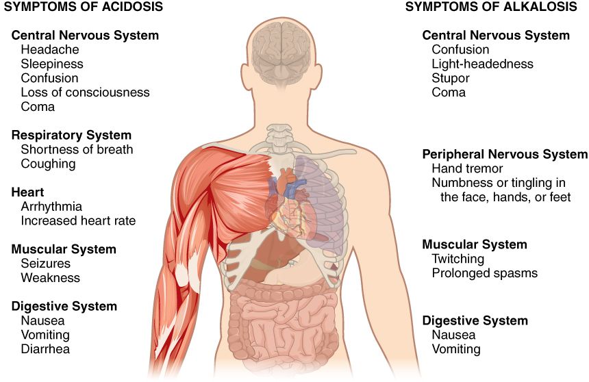 The four acid-base disorders reference figure