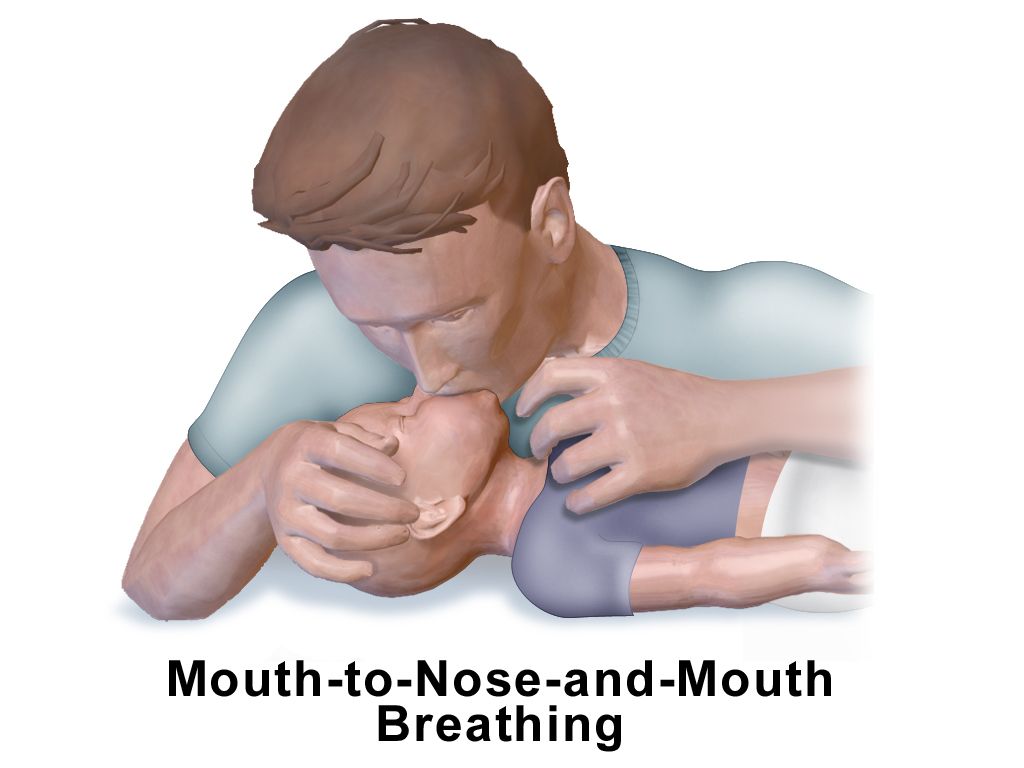 A clinician assessing an infant&rsquo;s breathing and colour during an emergency evaluation, with the infant undressed on a resuscitation surface.