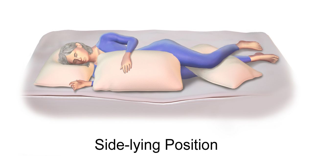 Illustration of lumbar puncture technique showing a patient curled in the lateral decubitus position with a spinal needle inserted between the L3 and L4 vertebrae into the subarachnoid space