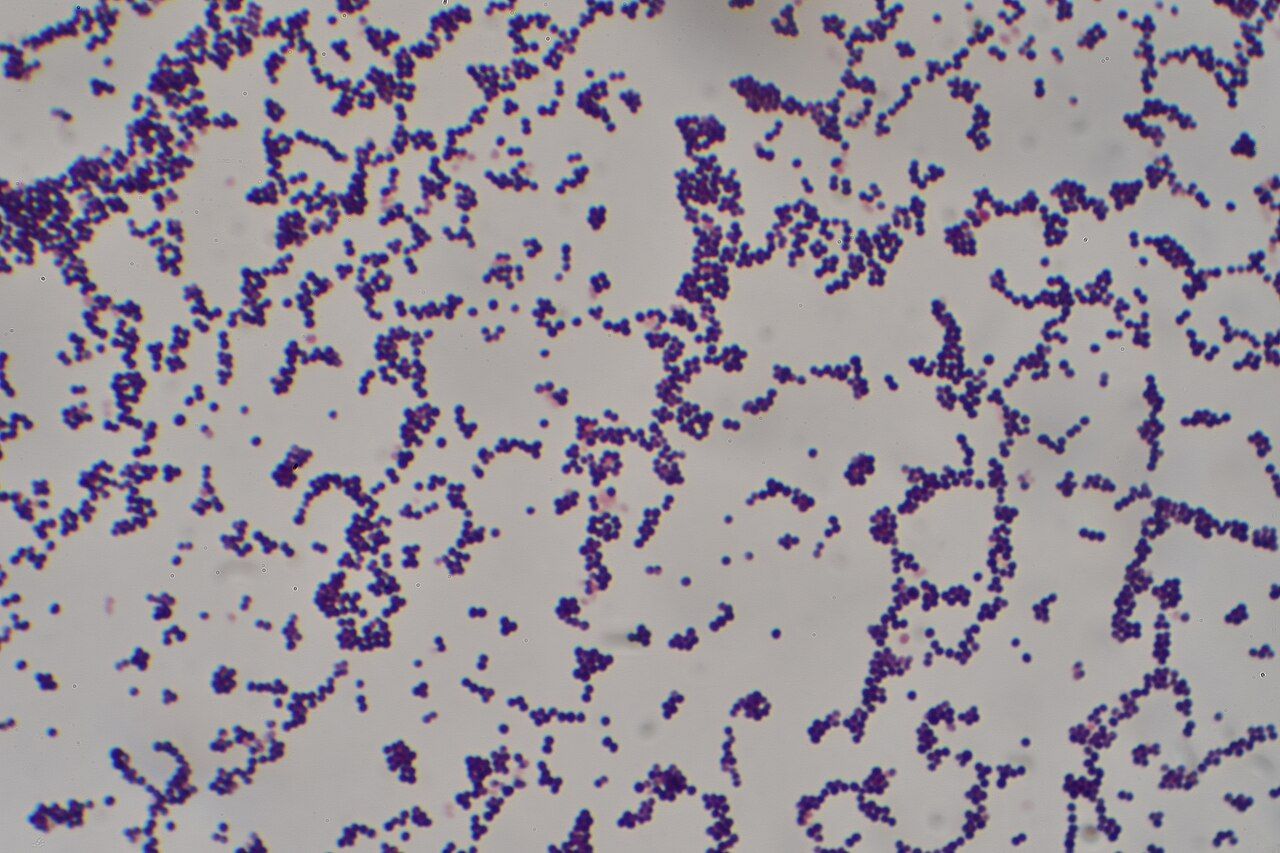 A Gram stain reported as gram-positive cocci in clusters narrows the field to staphylococci hours before the final identification and susceptibilities are available.