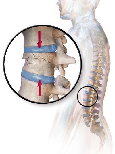 An articulated human vertebral column showing individual vertebrae stacked from cervical to sacral regions