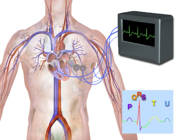 Electrocardiogram tracings comparing a normal sinus rhythm with bradycardia and tachycardia