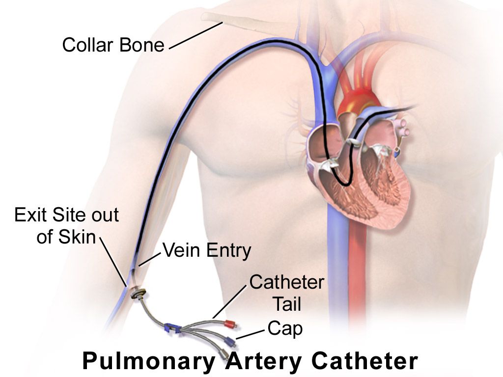 Schematic diagram of the systemic and pulmonary circuits showing arteries carrying blood away from the heart, the capillary beds of the body and lungs, and veins returning blood to the right atrium