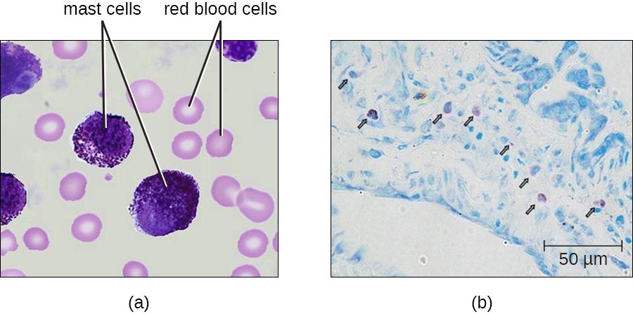 A mast cell releasing histamine granules that trigger the inflammatory response