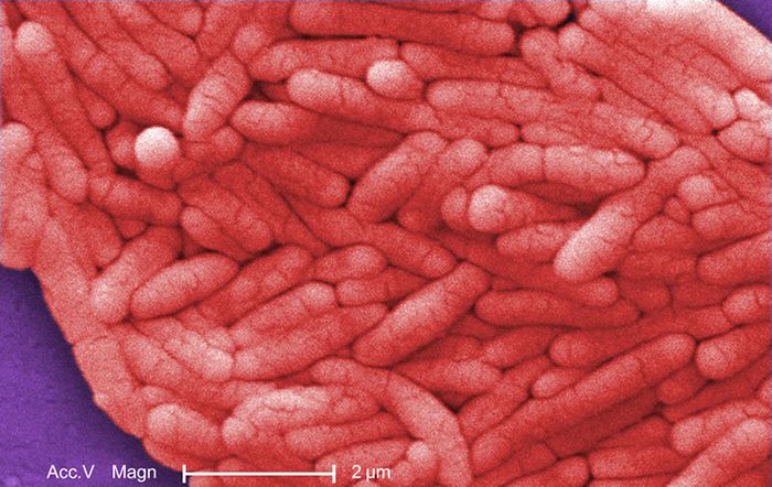 Salmonella bacteria, a common cause of foodborne gastrointestinal illness