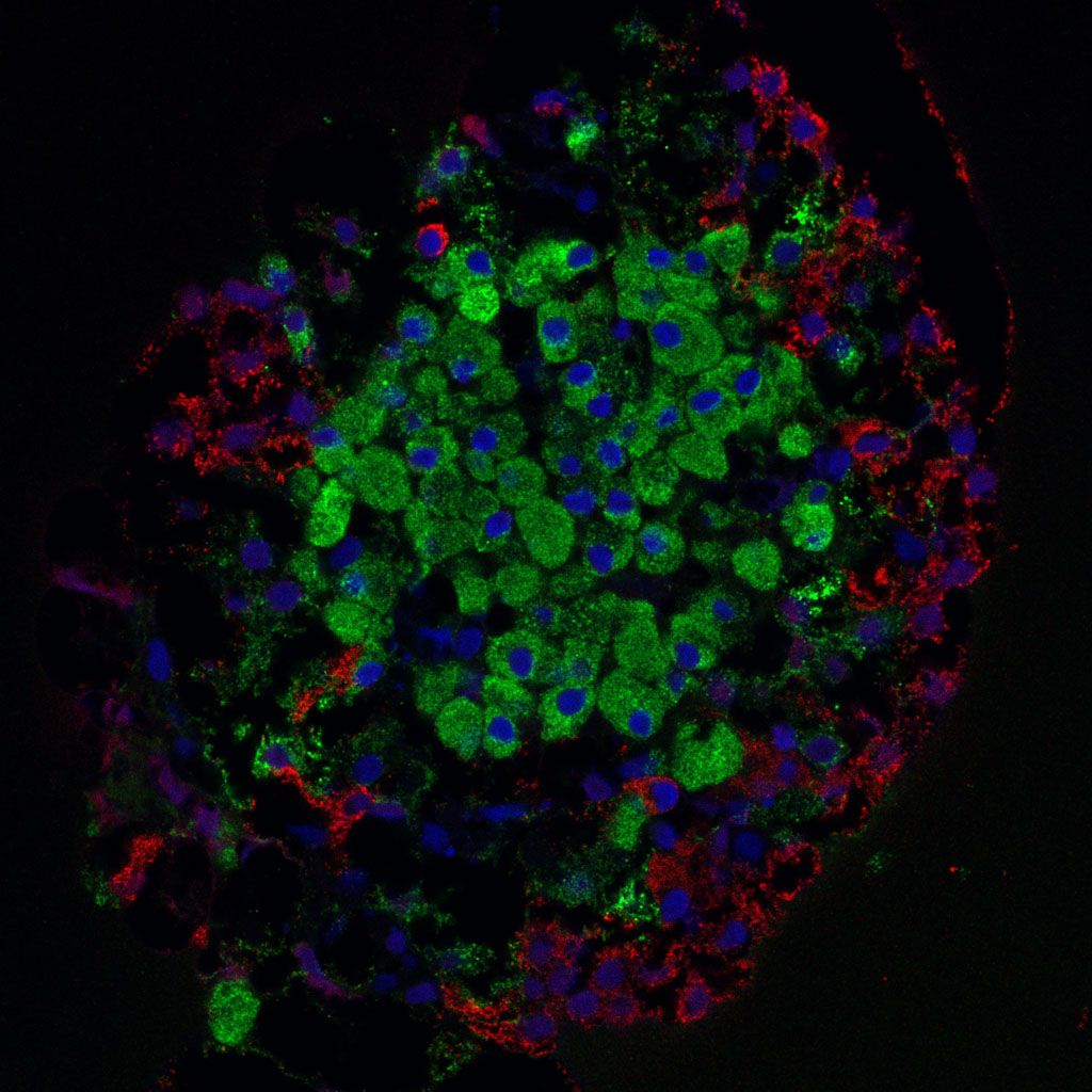 Micrograph of a pancreatic islet, the source of insulin and glucagon