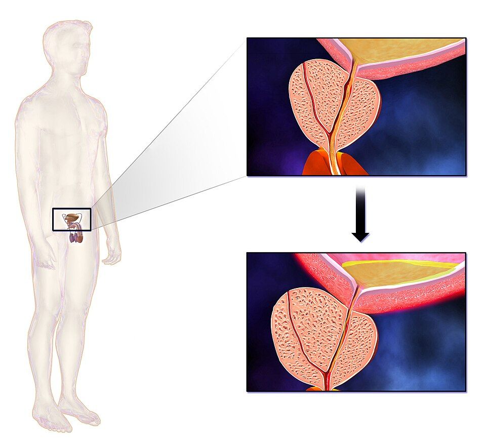 Male disorders reference figure
